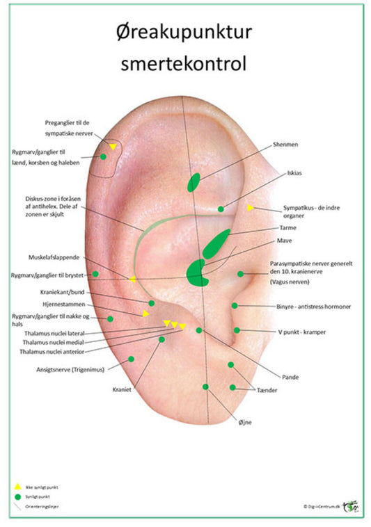 Planche smertekontrol øreakupunktur / akupressur